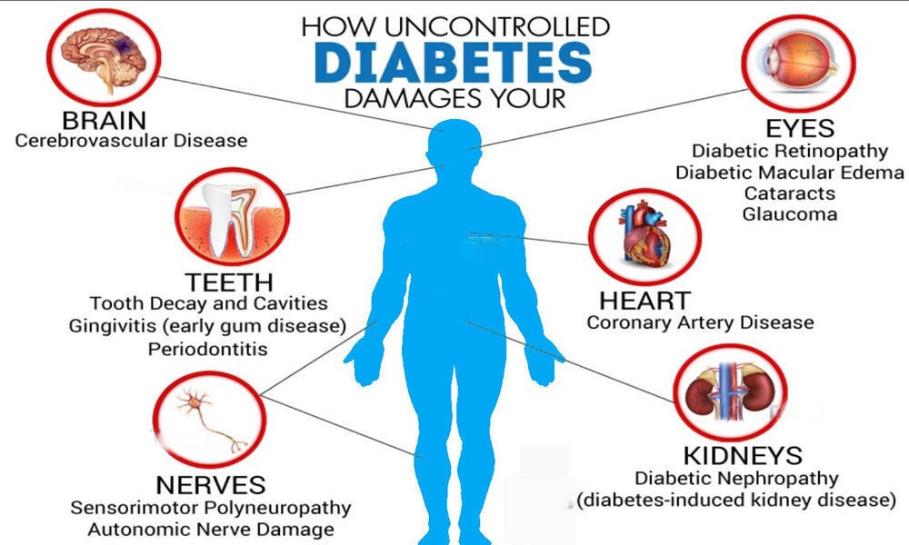 "Infographic showing how uncontrolled diabetes damages organs including the brain, eyes, heart, kidneys, nerves, and teeth."